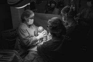 Nasterea vaginala instrumentala cu ventuza (vid-extractor). Ce implica si cand se apeleaza la ea?