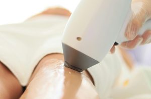 De este importanta vizita la dermatolog inainte de a merge la o epilare definitiva laser Iaşi la salon?