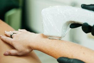 Manevrarea laserului in timpul sedintelor de epilare definitiva laser Bucureşti. Bune practici si recomandarile specialistilor