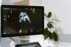 Placenta anterioara. Ce este, diagnosticare si complicatii