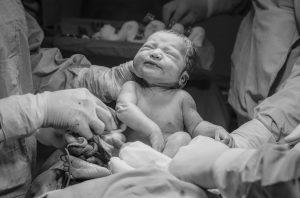 Spectrul de placenta accreta (PAS), o cauza a complicatiilor in sarcina si la nastere