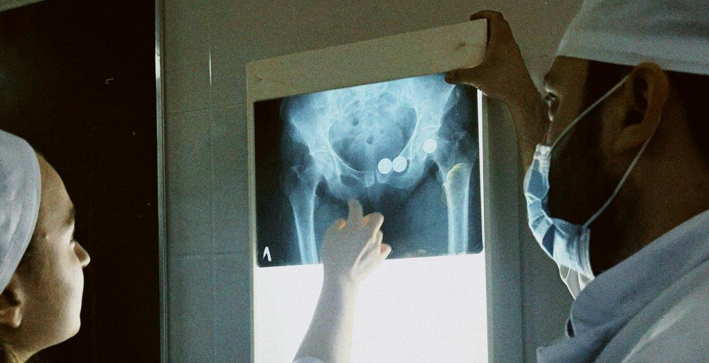 Boala inflamatorie pelvina, infectia tractului genital superior feminin care poate afecta fertilitatea