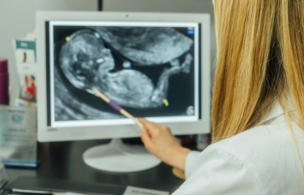 Sindromul Transfuzor-Transfuzat (STT): Ghid complet despre complicatia grava din sarcina gemelara