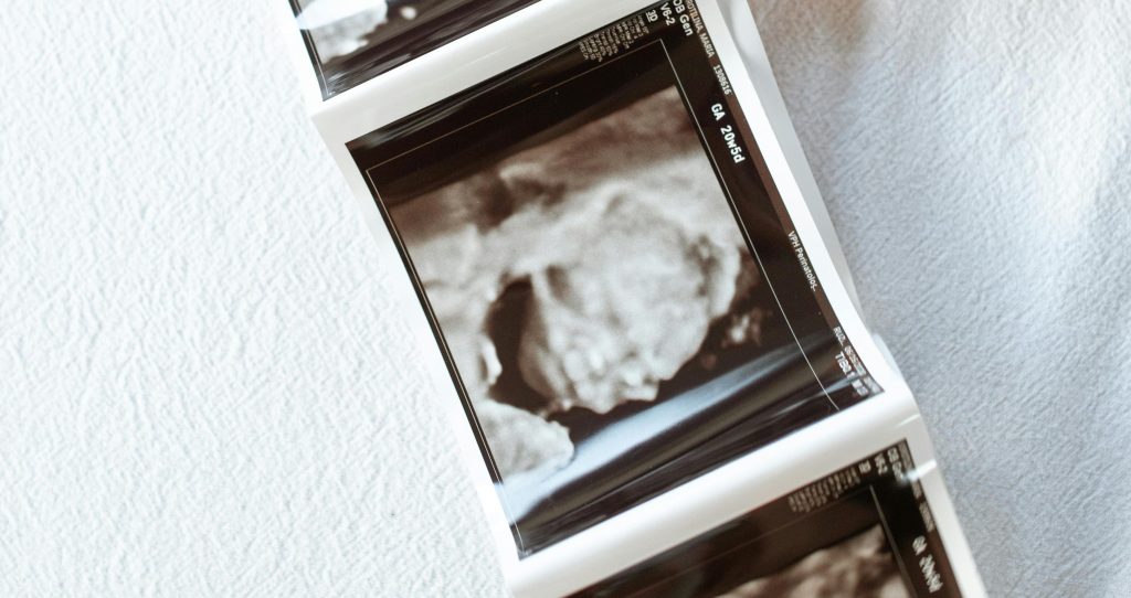 Bebelusii plang sau scot sunete cat se afla in uterul mamei?