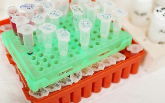 Testul Babes-Papanicolau (PAP) in timpul sarcinii. Este sigur si ce riscuri implica pentru mamica si bebe?