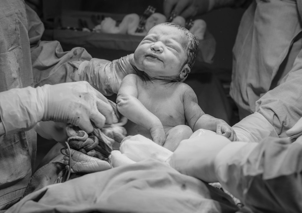 Encefalopatia hipoxic-ischemica. De ce apare la nastere, poate fi prevenita si cum se manifesta?