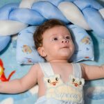 Plagiocefalia (sindromul capului turtit). Preventie acasa si diagnosticare corecta