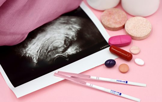 Uterul didelfic, defectul congenital care poate aduce complicatii la nasterea vaginala