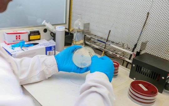 CAPA-IVM, o metoda utila in reducerea dependentei de injectii hormonale in timpul tratamentelor de fertilizare in vitro